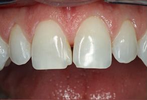 Granger Dentistry | Sedation Dentistry, Botox reg and Crowns amp Caps